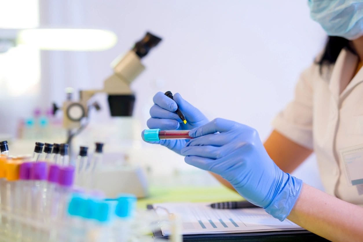 Scientist examining blood sample in laboratory.
